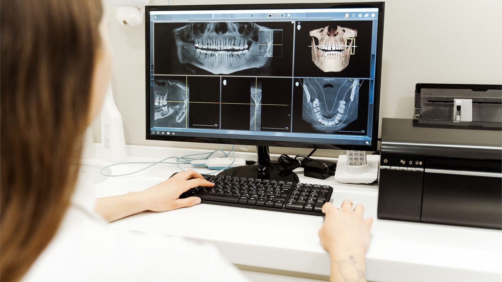 3 Boyutlu Dental Tomografi