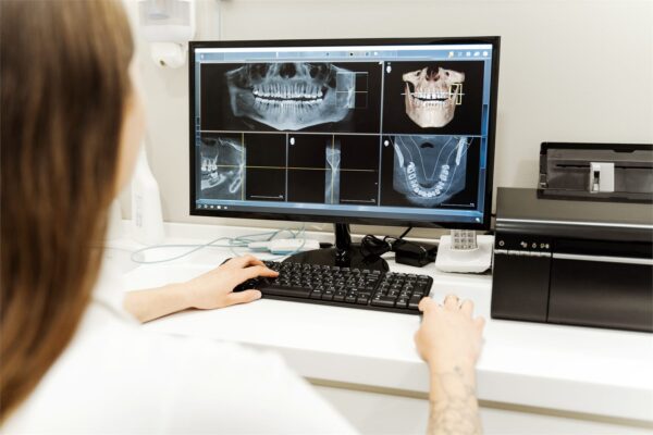 3 Boyutlu Dental Tomografi